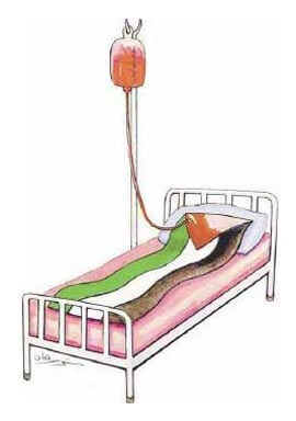 Les perfusions européennes maintiennent le régime palestinien en vie