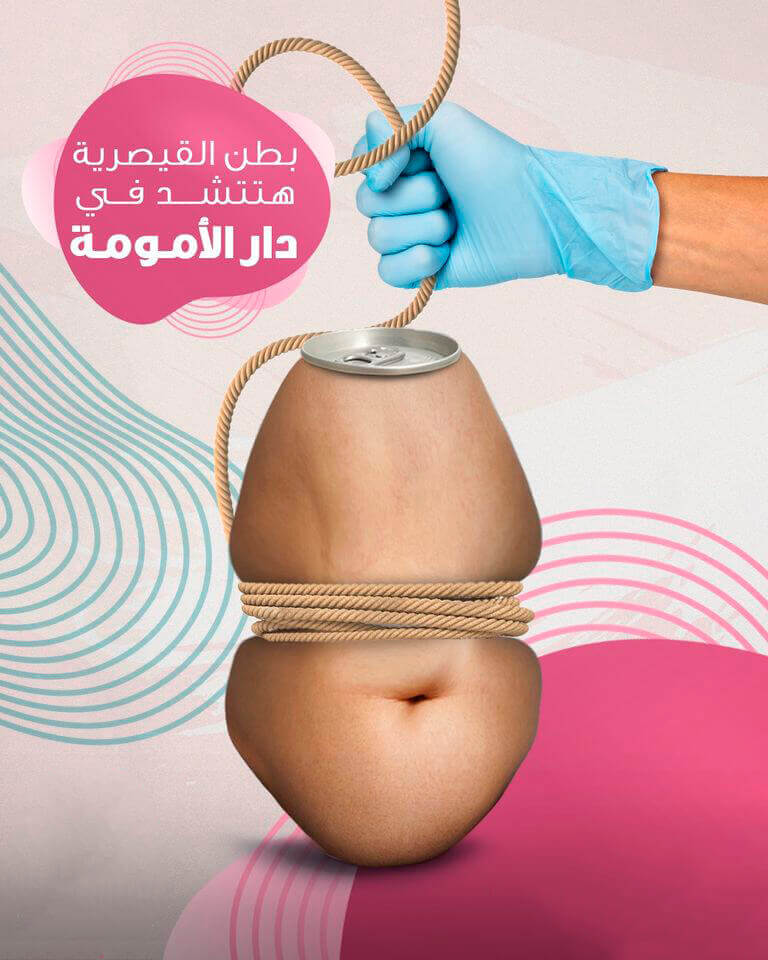 Égypte. Accoucher à ventre ouvert : quand la césarienne devient la norme | Babelmed