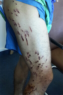 عن السوريين الذين نسيهم التاريخ | Babelmed