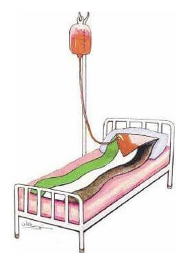 Les perfusions européennes maintiennent le régime palestinien en vie | Babelmed