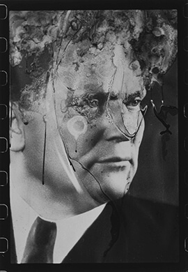 L'arte della resistenza | Babelmed