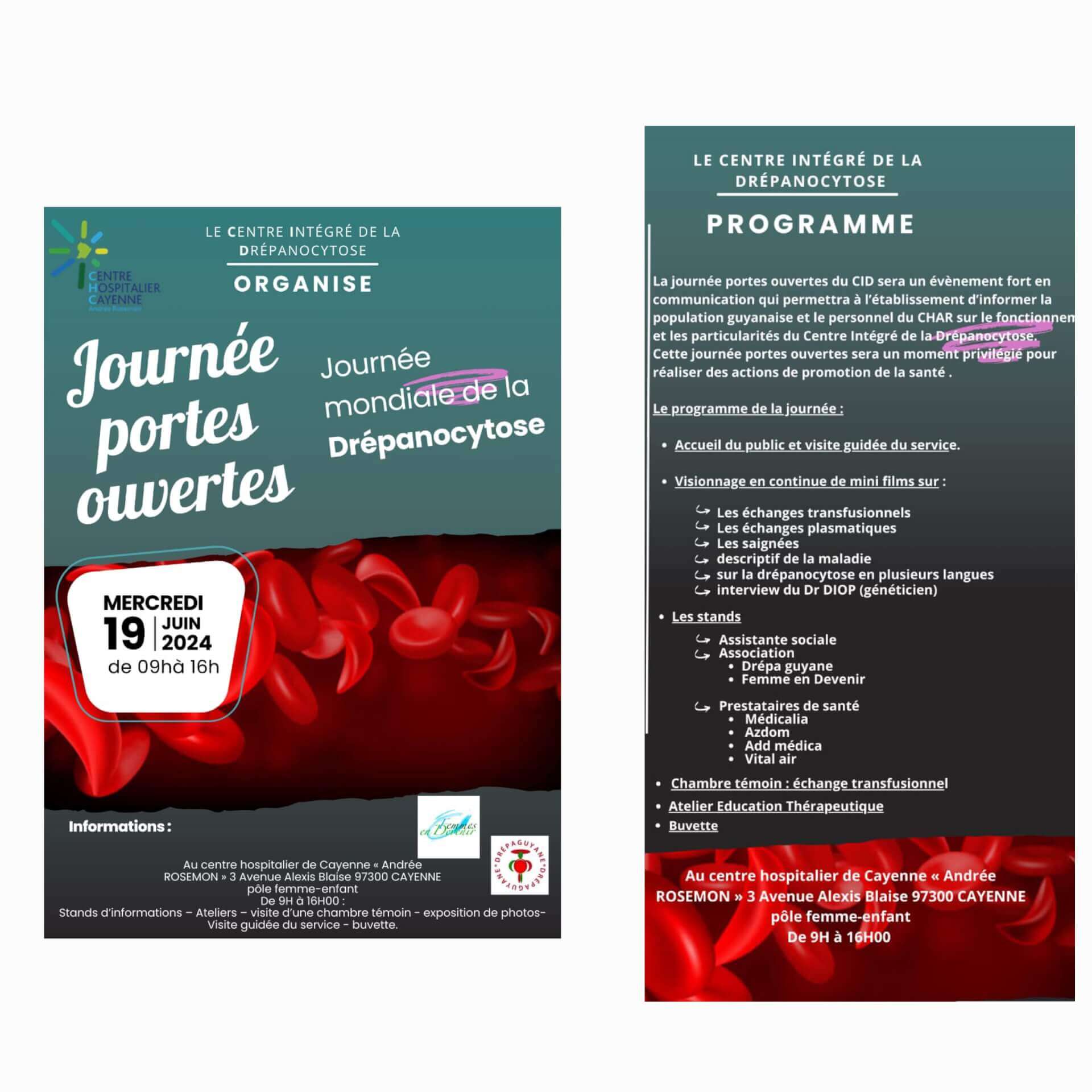 Journée portes ouvertes au Centre Intégré de la Drépanocytose | DrepaGuyane