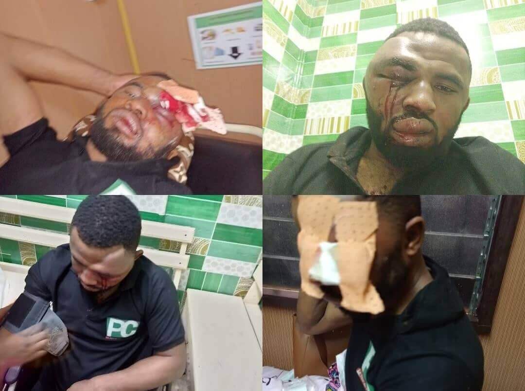 Cameroun: Tentative d'assassinat de Paul Tchouta | Tournons la Page