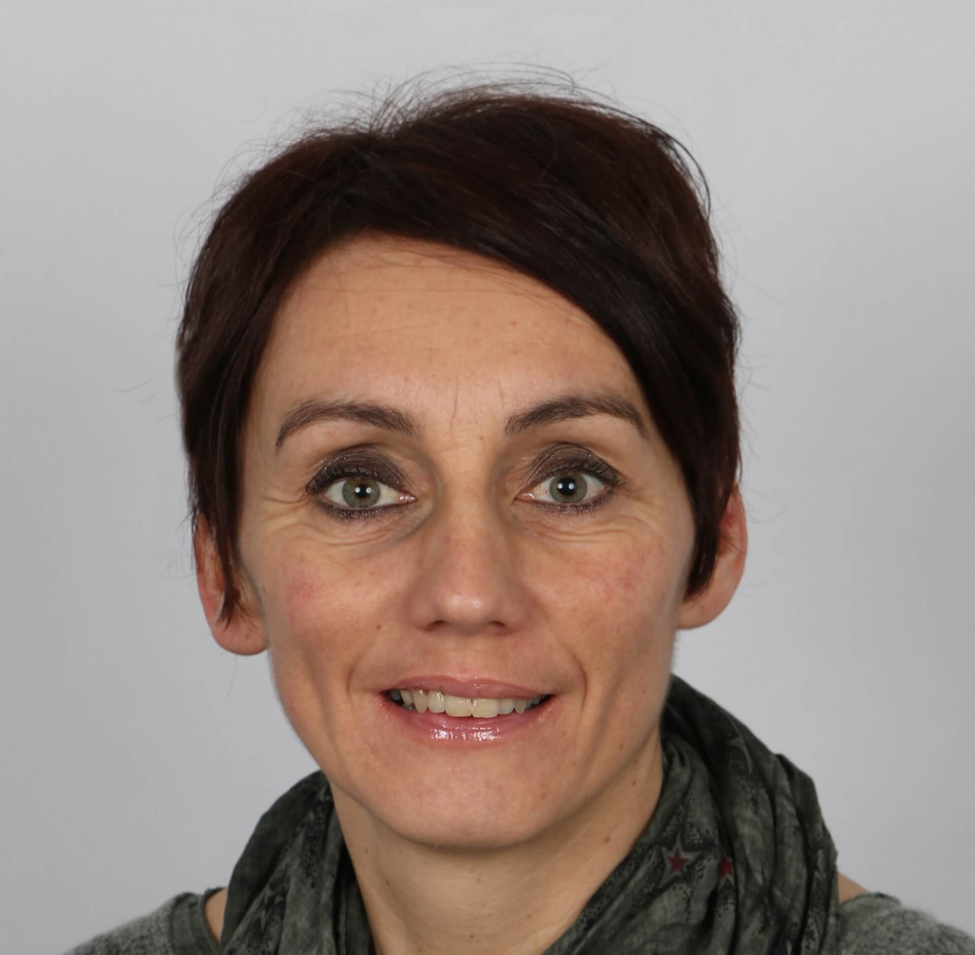 Florence LAFFONT | Trisomie 21 Nouvelle Aquitaine